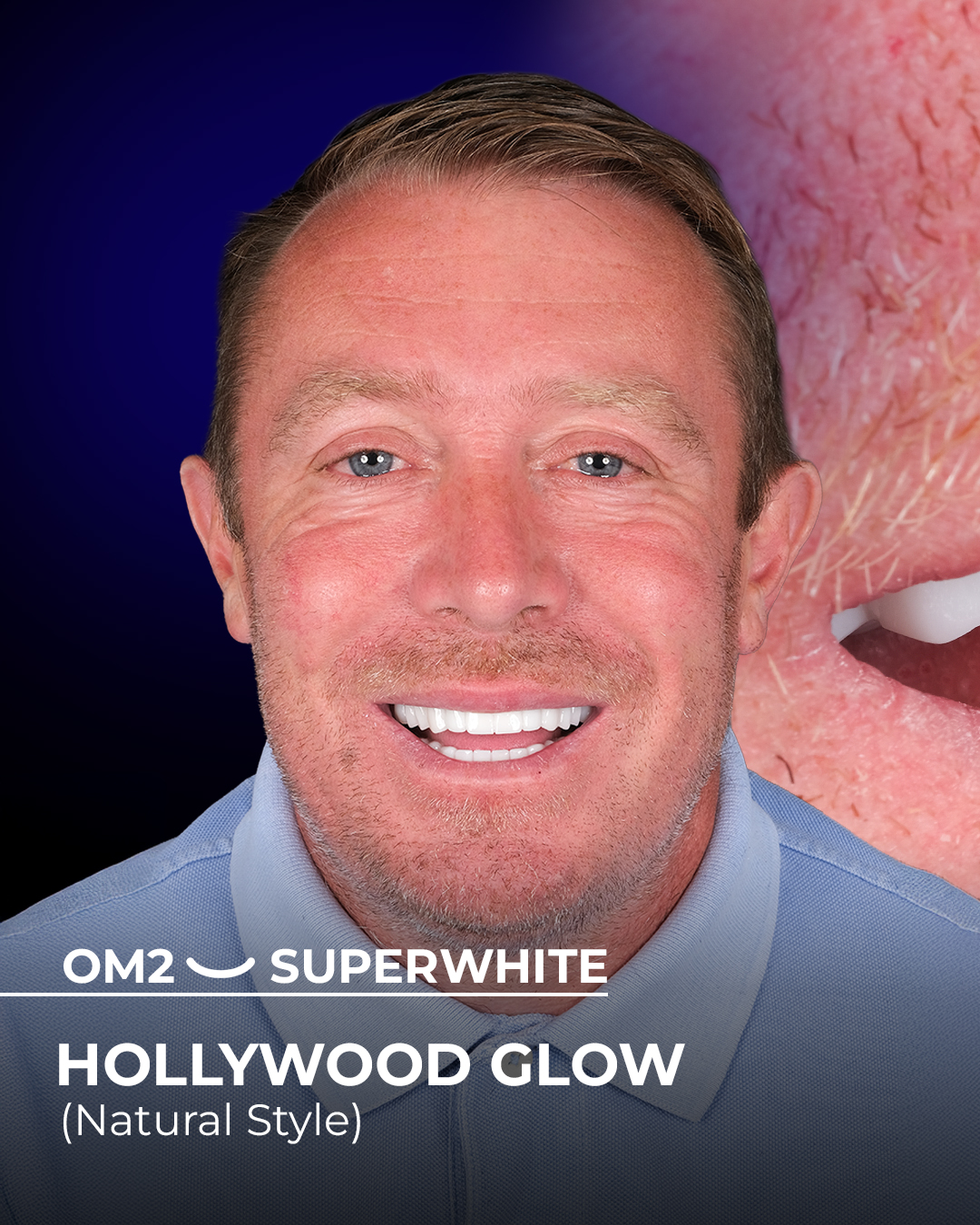 Dental Holiday in Antalya - Packages Deals, Cost & Price 2025