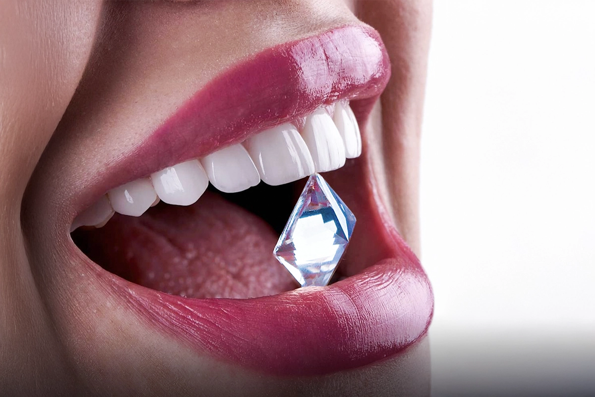 E Max Veneers in Antalya 2025 Turkey Teeth
