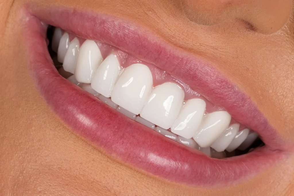 Zirconium Crowns Near me 2025