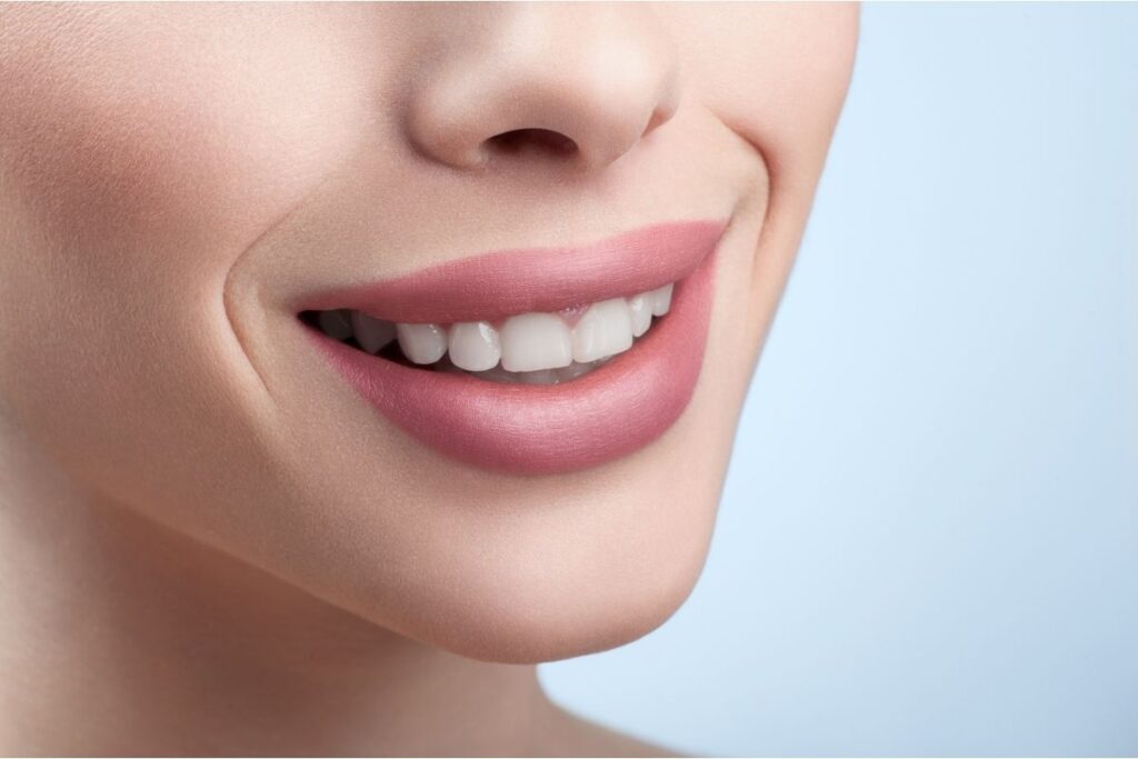 Turkey Teeth in Antalya