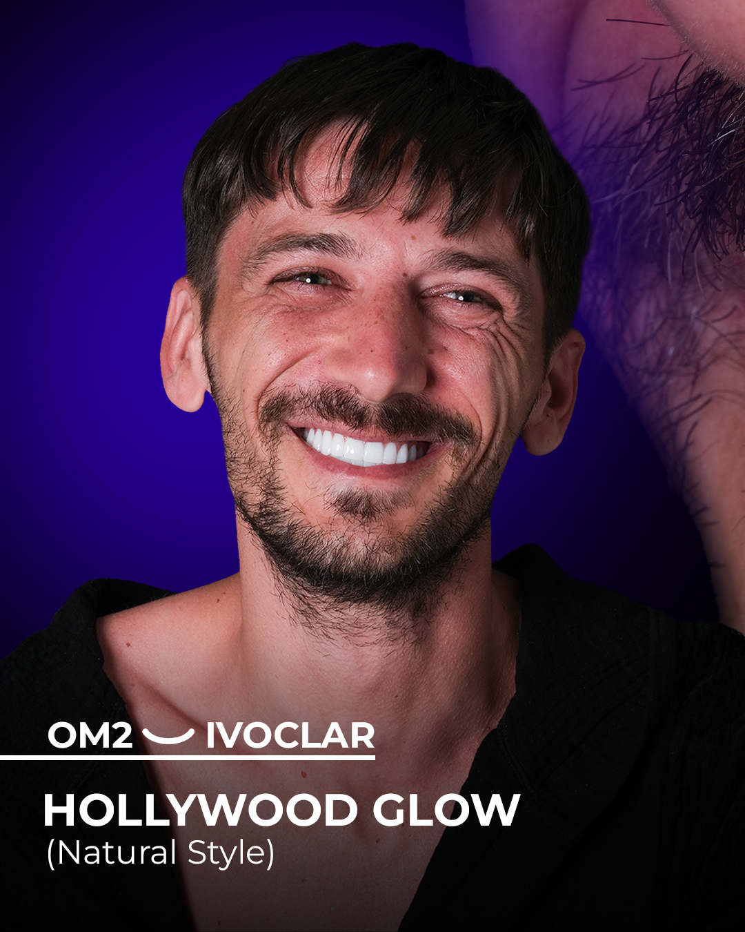 Dental Holiday in Antalya - Packages Deals, Cost & Price 2025