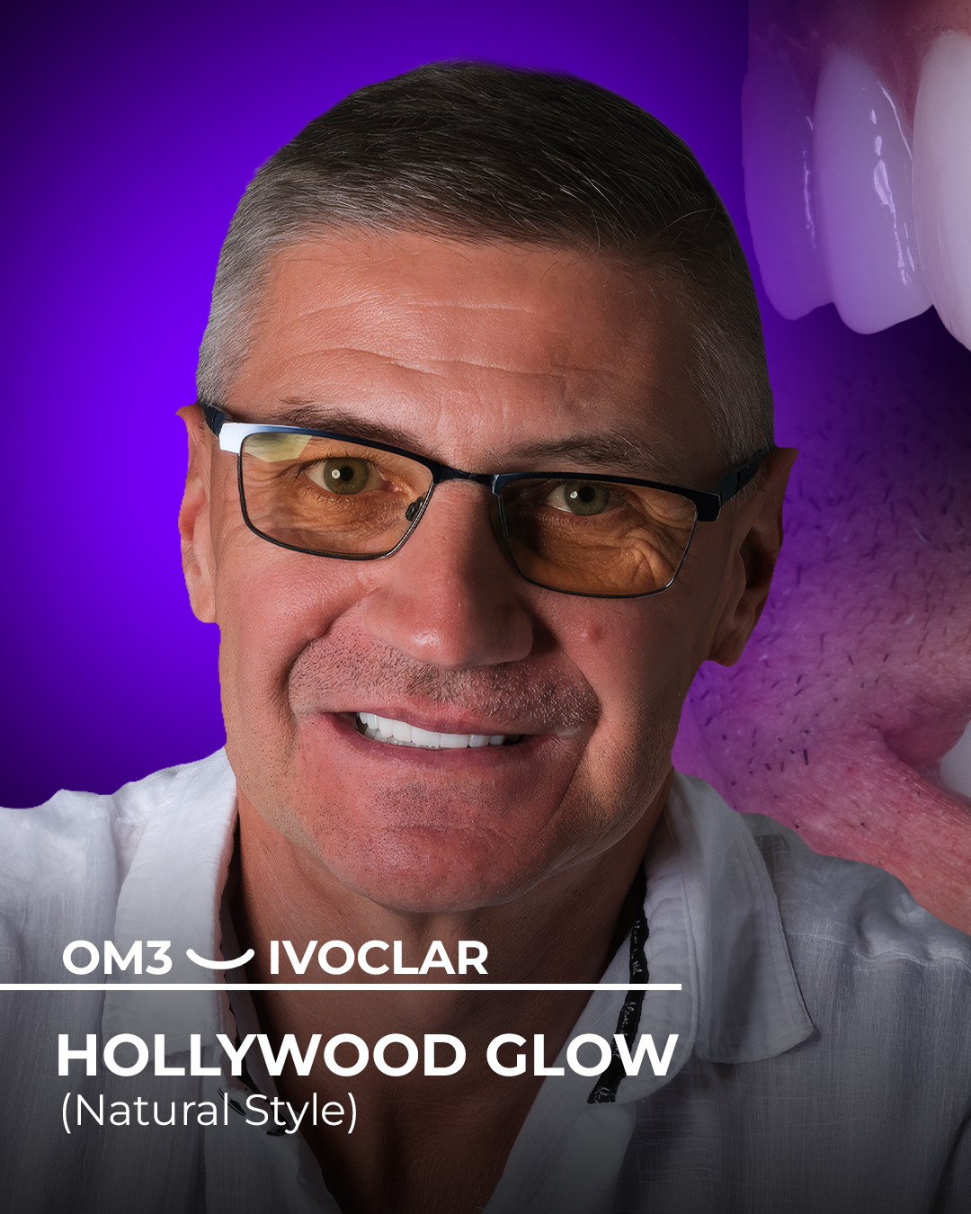 Dental Holiday in Antalya - Packages Deals, Cost & Price 2025