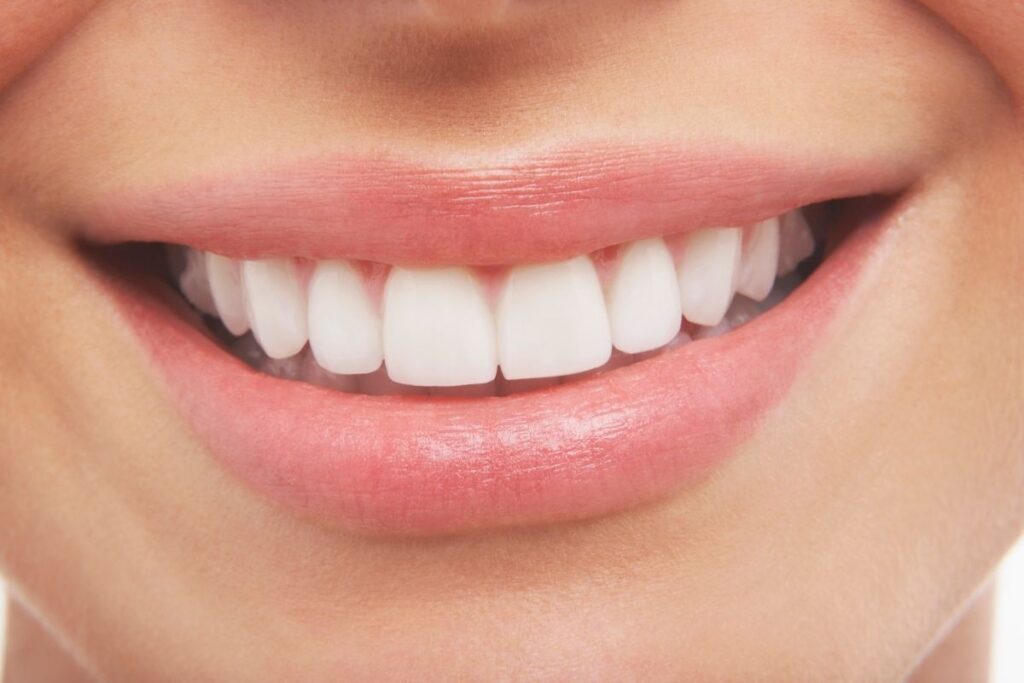 All on 6 Dental Implants in Antalya
