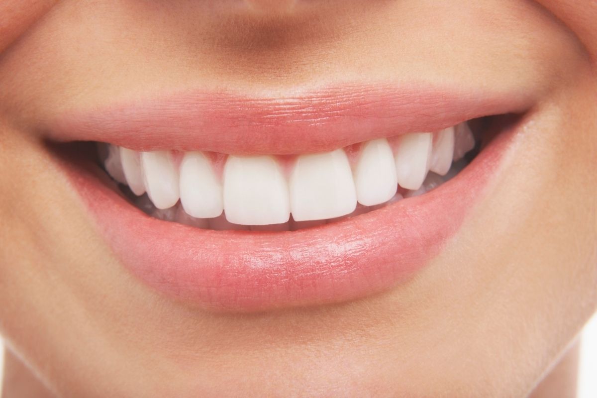 All on 6 Dental Implants in Antalya