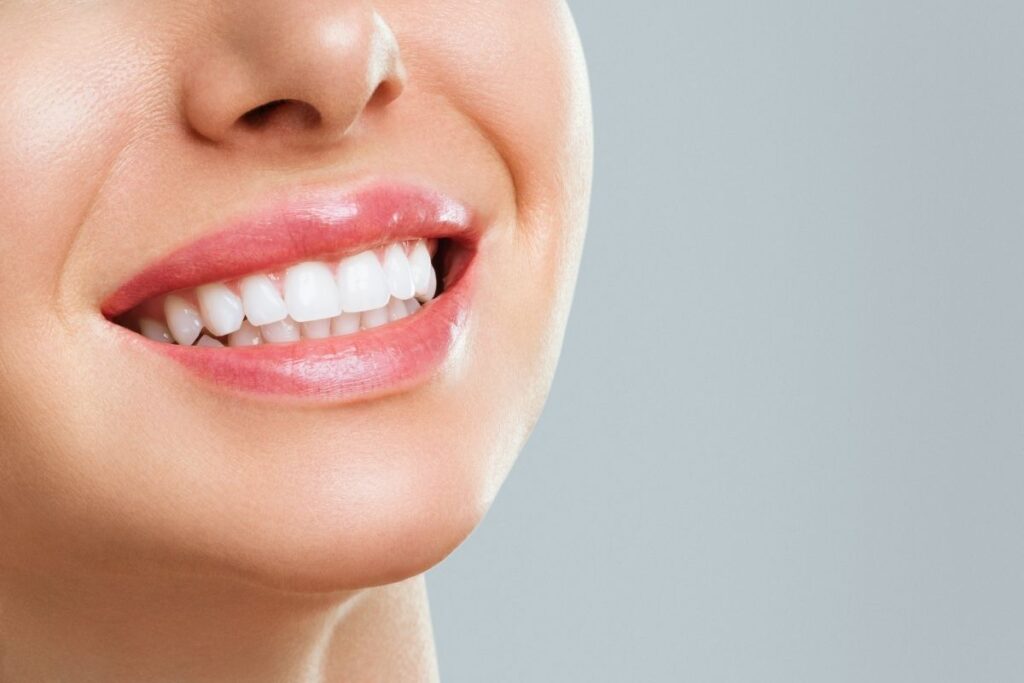 Dental Veneers in Antalya 2025