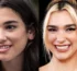 Dua Lipa Teeeth 2025