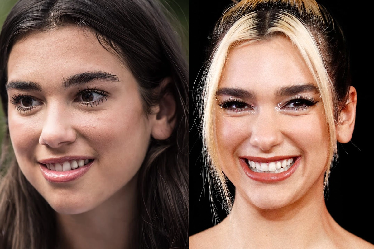 Dua Lipa Teeeth 2025