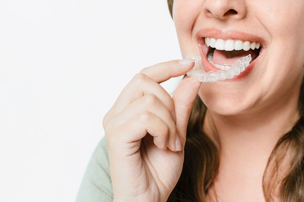 Clear Aligner near me