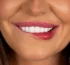 Smile Makeover in Antalya 2025