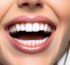 Top 5 Myths About Teeth Whitening You Shouldn’t Believe