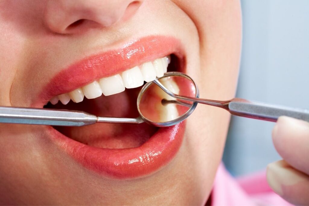 Dental Treatment in Turkey 2025
