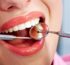 Dental Treatment in Turkey 2025