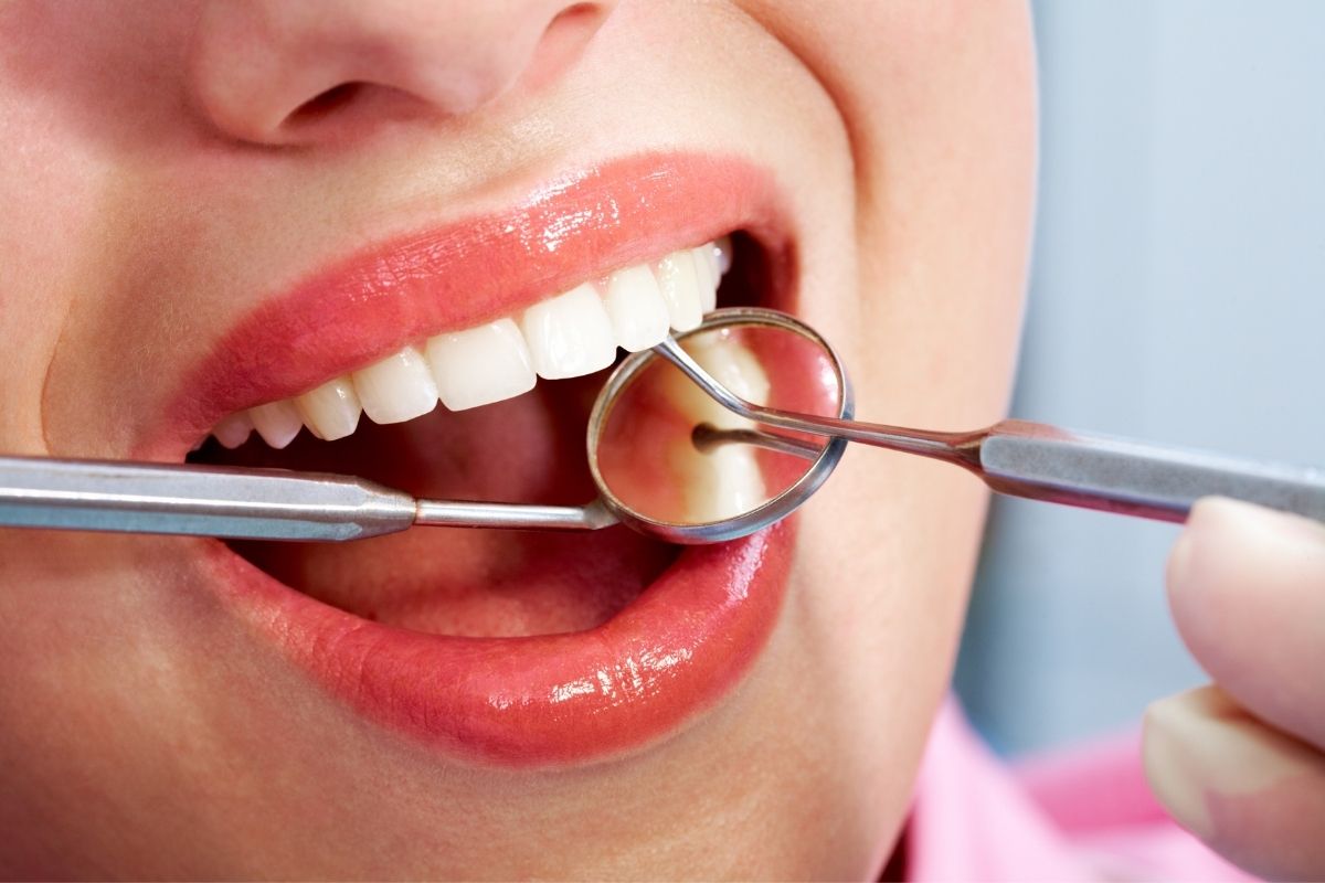 Dental Treatment in Turkey 2025